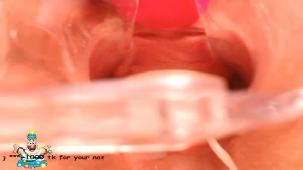 稀缺资源阴道内放置跳蛋高清近景内窥镜看阴道内部变化白浆往外流再给你看看子宫口太粉嫩了